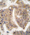 TRAF Interacting Protein antibody, 61-527, ProSci, Immunohistochemistry paraffin image 