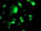 NudE Neurodevelopment Protein 1 Like 1 antibody, MA5-25657, Invitrogen Antibodies, Immunocytochemistry image 