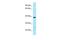 Abhydrolase Domain Containing 6 antibody, PA5-45761, Invitrogen Antibodies, Western Blot image 