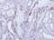 Epithelial Cell Adhesion Molecule antibody, GTX113091, GeneTex, Immunohistochemistry paraffin image 