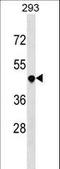 TNF Receptor Superfamily Member 25 antibody, LS-C157235, Lifespan Biosciences, Western Blot image 
