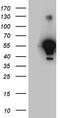 Aldehyde Dehydrogenase 7 Family Member A1 antibody, TA811280, Origene, Western Blot image 