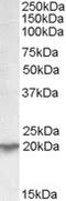 Ubiquitously Expressed Prefoldin Like Chaperone antibody, STJ71402, St John