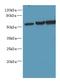 Oxysterol Binding Protein Like 2 antibody, A60134-100, Epigentek, Western Blot image 