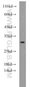 Phosphomannomutase 2 antibody, 10666-1-AP, Proteintech Group, Western Blot image 