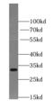 Translocase Of Inner Mitochondrial Membrane Domain Containing 1 antibody, FNab08705, FineTest, Western Blot image 