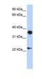 Engrailed Homeobox 1 antibody, orb329552, Biorbyt, Western Blot image 