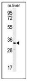Clavesin 2 antibody, AP53672PU-N, Origene, Western Blot image 
