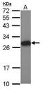 Testis Expressed Metallothionein Like Protein antibody, GTX117915, GeneTex, Western Blot image 