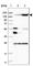 Non-SMC Condensin I Complex Subunit D2 antibody, HPA037363, Atlas Antibodies, Western Blot image 