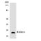 RAB6A, Member RAS Oncogene Family antibody, LS-C200555, Lifespan Biosciences, Western Blot image 