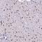 DNA Polymerase Delta 1, Catalytic Subunit antibody, FNab06606, FineTest, Immunohistochemistry paraffin image 