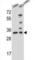 Nth Like DNA Glycosylase 1 antibody, abx026319, Abbexa, Western Blot image 