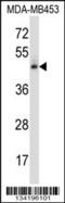 Nuclear Receptor Subfamily 2 Group F Member 1 antibody, 57-566, ProSci, Western Blot image 