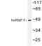 Heterogeneous Nuclear Ribonucleoprotein F antibody, LS-C176778, Lifespan Biosciences, Western Blot image 