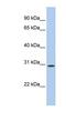 TP53 Target 5 antibody, NBP1-58923, Novus Biologicals, Western Blot image 