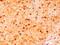 AIF1 antibody, GTX89367, GeneTex, Immunohistochemistry paraffin image 