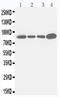 Integrin Subunit Beta 3 antibody, LS-C312789, Lifespan Biosciences, Western Blot image 