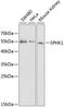 Sphingosine Kinase 1 antibody, A01390, Boster Biological Technology, Western Blot image 
