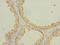 N-Myristoyltransferase 2 antibody, LS-C676171, Lifespan Biosciences, Immunohistochemistry paraffin image 