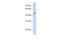 Transducin Beta Like 2 antibody, PA5-44095, Invitrogen Antibodies, Western Blot image 