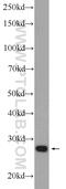 Thioredoxin Domain Containing 9 antibody, 25208-1-AP, Proteintech Group, Western Blot image 