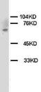 Checkpoint Kinase 2 antibody, LS-C171942, Lifespan Biosciences, Western Blot image 
