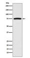 Fibroblast Growth Factor Receptor Substrate 2 antibody, M02798, Boster Biological Technology, Western Blot image 