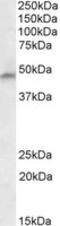 Phenylalanine Hydroxylase antibody, MBS422456, MyBioSource, Western Blot image 