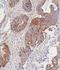 Cyclin Dependent Kinase 1 antibody, M00209-6, Boster Biological Technology, Immunohistochemistry paraffin image 