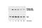 Tyrosine Kinase 2 antibody, 9321S, Cell Signaling Technology, Western Blot image 