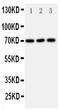 Solute Carrier Family 6 Member 4 antibody, PA1705, Boster Biological Technology, Western Blot image 