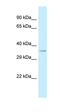 Cysteine Rich Secretory Protein LCCL Domain Containing 1 antibody, orb326443, Biorbyt, Western Blot image 