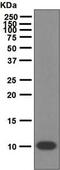 S100 Calcium Binding Protein P antibody, ab124743, Abcam, Western Blot image 