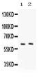 Pyruvate Kinase L/R antibody, PB9499, Boster Biological Technology, Western Blot image 