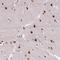 Zinc Finger Protein 672 antibody, HPA055779, Atlas Antibodies, Immunohistochemistry paraffin image 