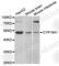Cytochrome P450 Family 19 Subfamily A Member 1 antibody, A2161, ABclonal Technology, Western Blot image 
