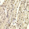 DNA Nucleotidylexotransferase antibody, LS-C334595, Lifespan Biosciences, Immunohistochemistry frozen image 