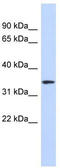 Olfactory Receptor Family 13 Subfamily C Member 5 antibody, TA332317, Origene, Western Blot image 