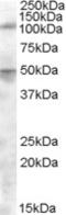 Endoplasmic Reticulum Aminopeptidase 2 antibody, EB08581, Everest Biotech, Western Blot image 