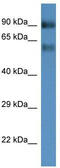 Solute Carrier Family 6 Member 15 antibody, TA334627, Origene, Western Blot image 