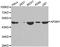 AP2M1 antibody, STJ22628, St John