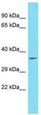 WW Domain Binding Protein 1 Like antibody, TA331881, Origene, Western Blot image 