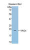 Lecithin-Cholesterol Acyltransferase antibody, LS-C304796, Lifespan Biosciences, Western Blot image 