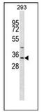 Glycine-N-Acyltransferase antibody, AP51864PU-N, Origene, Western Blot image 