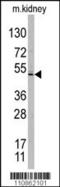 Taspase 1 antibody, 56-979, ProSci, Western Blot image 