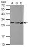 b5R.2 antibody, GTX104417, GeneTex, Western Blot image 