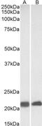 Caveolin 3 antibody, PA5-19116, Invitrogen Antibodies, Western Blot image 