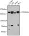 Protein Phosphatase 1 Regulatory Subunit 12A antibody, 13-210, ProSci, Western Blot image 
