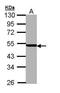 26S protease regulatory subunit 6A antibody, PA5-22041, Invitrogen Antibodies, Western Blot image 